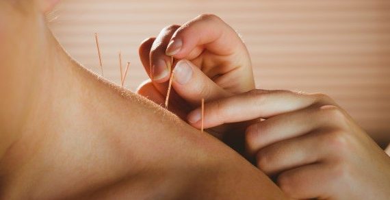 De ce sa consultati un acupuncturist?